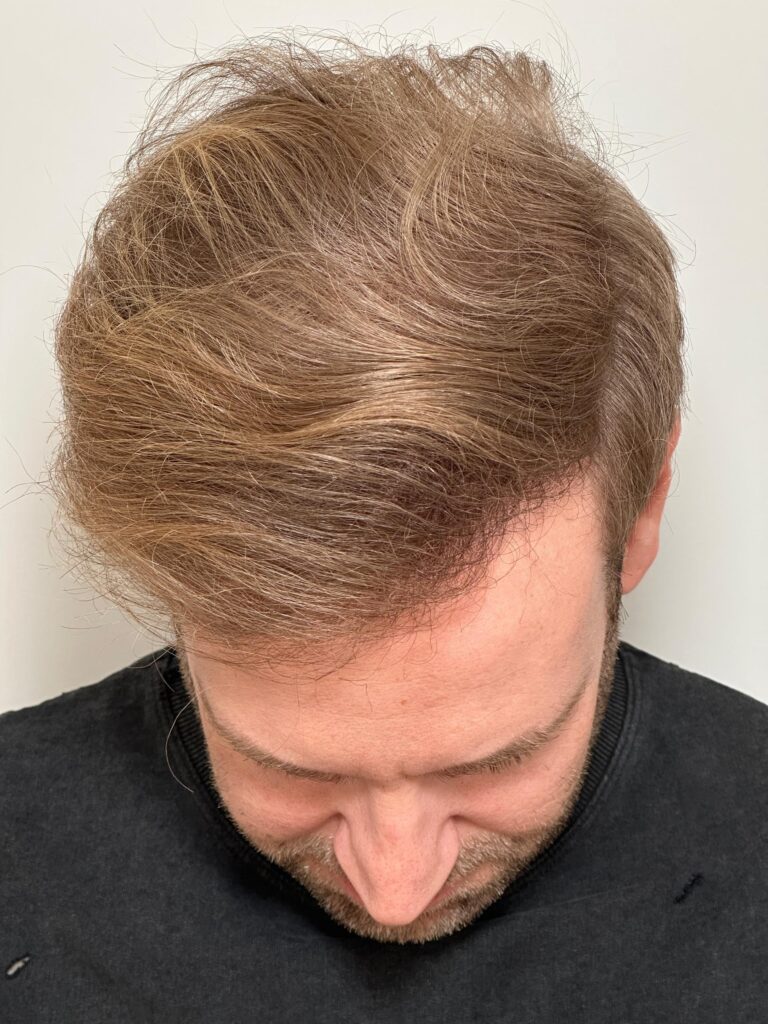 After